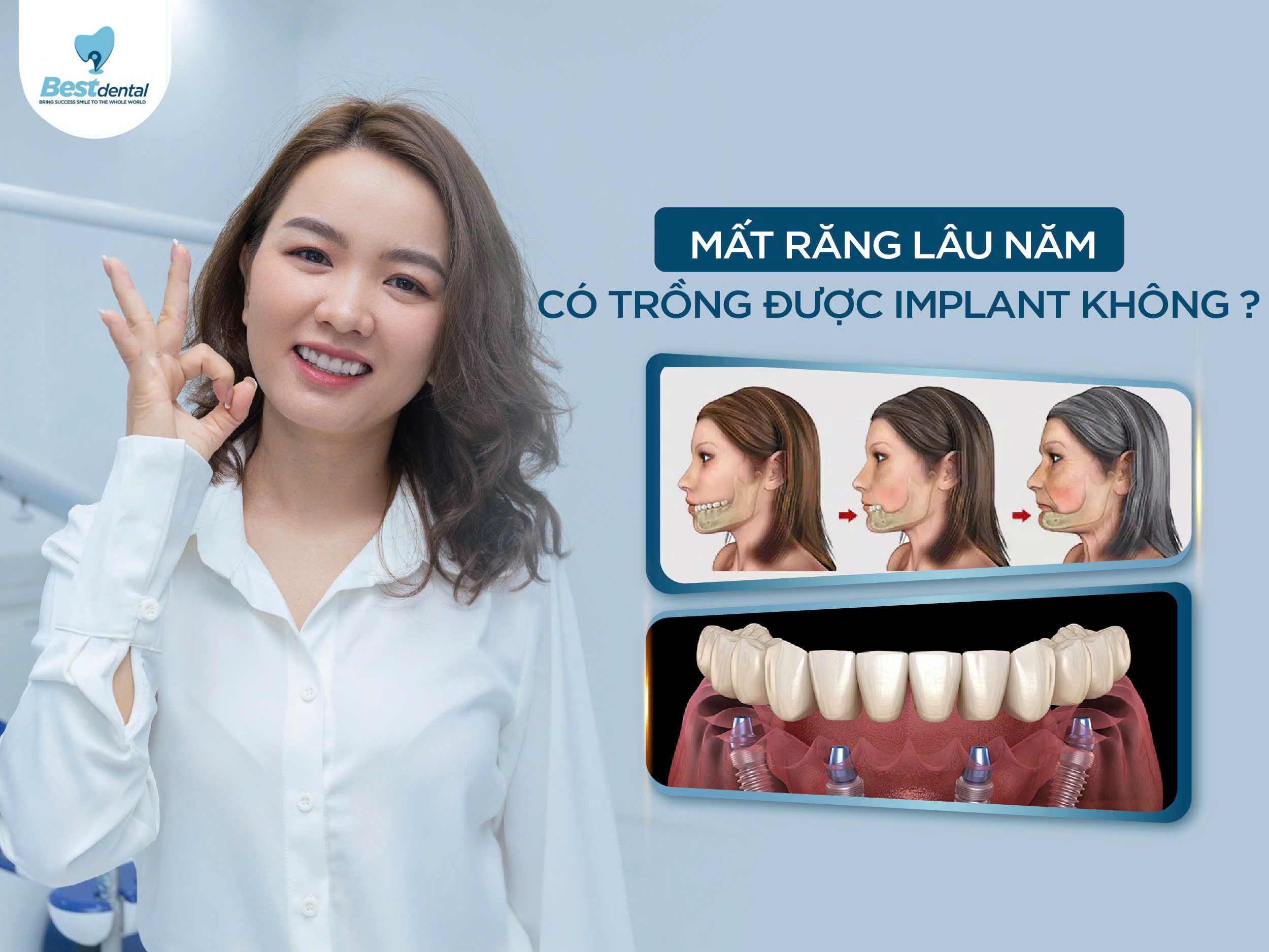 Mất răng lâu năm có thể trồng lại được không?